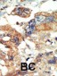 PI4KCB Antibody (N-term)